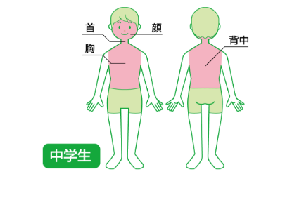アトピー性皮ふ炎　中学生