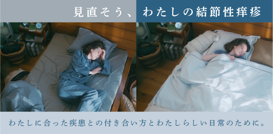見直そう、わたしの結節性痒疹